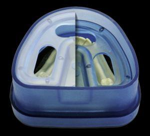 Dublisil Kyvette blå transparent*