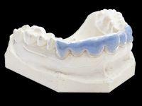 BioBleach Soft 20 stk 120x1 mm*