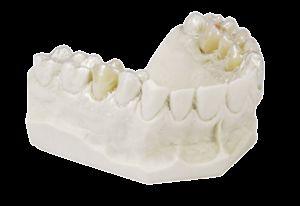 Drufolen H 120 x 0.6 40 stk*