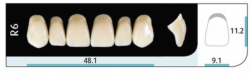 Quint fortand 6 stk up farve A1 R6*