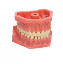 Kæbemodel O/U med 32 tænder Model A-3*