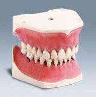 A-PZ Over-under model til parodontose*