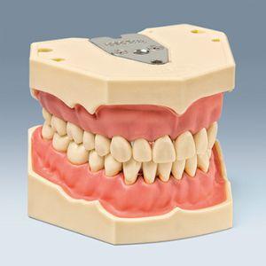 Arbejdsmodel O/U monteret 32 tænder AG-3*