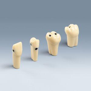 Modeltand AG-3 ZK V1 UK 46 med caries*