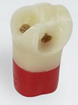 Modeltand AG-3 ZSDPK 300 V1 OK 46 med caries NY*