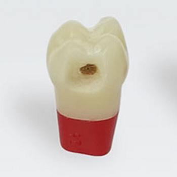 Modeltand AG-3 ZSDPK 300 V1 OK 26 med caries NY*