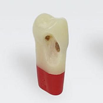 Modeltand AG-3 ZSDPK 300 V1 OK 24 med caries NY*