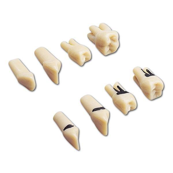 Modeltand A-PB Z uden skrue nr 23 (+3)*