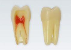 Modeltand ANA-4 Z3RN 100 stk nr. 16*