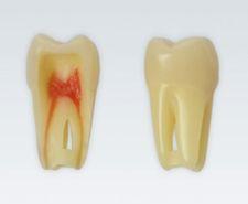 Modeltand ANA-4 Z3RN 100 stk nr. 26*