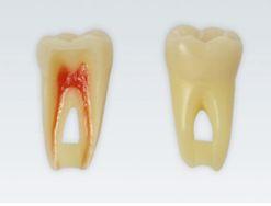 Modeltand ANA-4 Z3RN 100 stk nr. 36*
