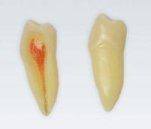 Modeltand ANA-4 Z3RN 100 stk nr. 45*