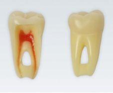 Modeltand ANA-4 Z3RN 100 stk nr. 46*