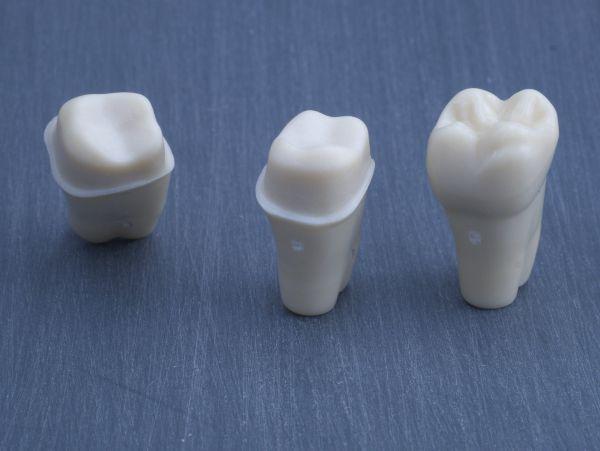 Modeltand præpareret AG-3 ZP 16 99-004*