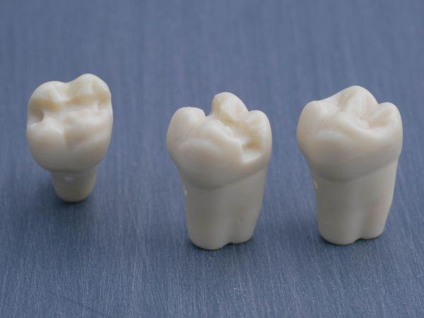 Modeltand præpareret AG-3 ZP 16 99-005*