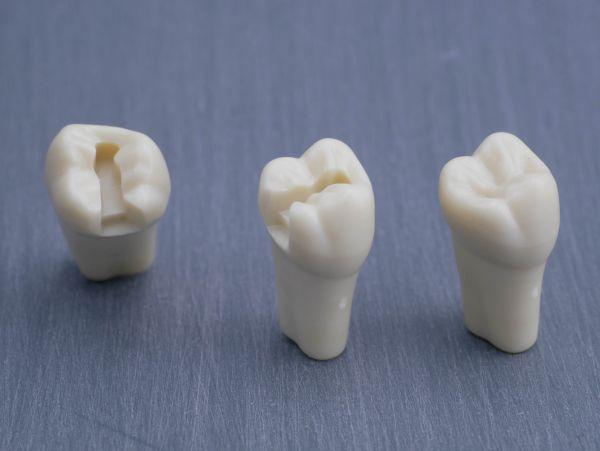 Modeltand præpareret AG-3 ZP 17 99-001*