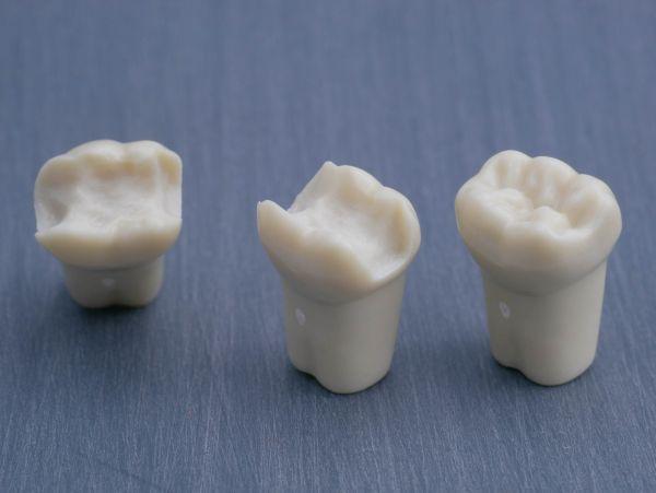 Modeltand præpareret AG-3 ZP 36 99-001*