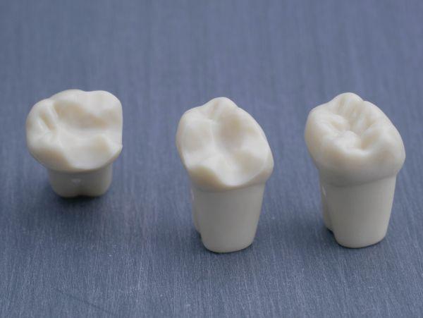 Modeltand præpareret AG-3 ZP 36 99-004*