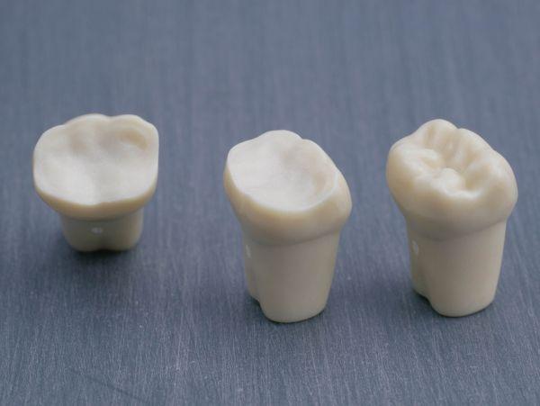 Modeltand præpareret AG-3 ZP 36 99-006*