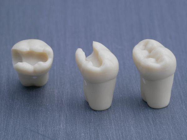 Modeltand præpareret AG-3 ZP 46 99-004*