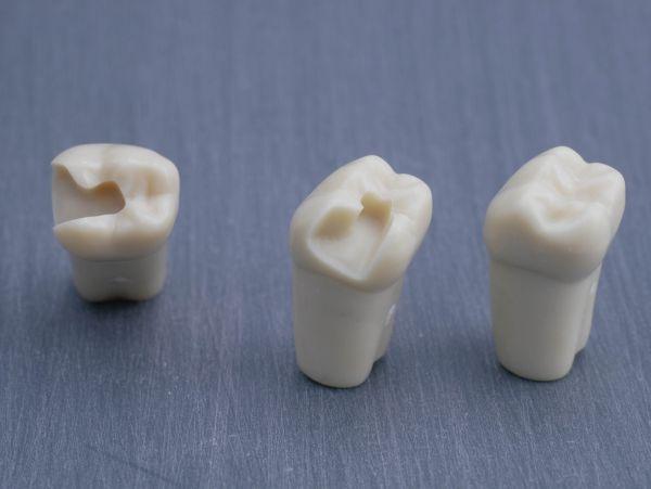 Modeltand præpareret AG-3 ZP 47 99-001*