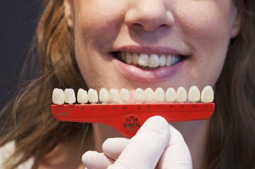 Directa Kroner translucent 5 stk nr 21 lateral OK*