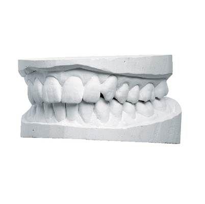 Moldabaster hvid normal karton 20 kg*