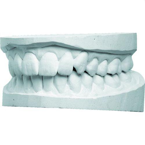 Moldabaster S 20 kg kartong