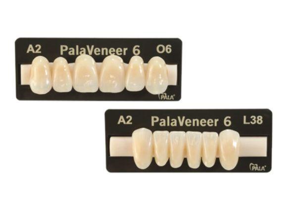 PalaVeneer fortand 6 stk farve A1 S8*