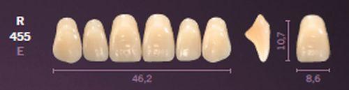 Mondial fortand 6 stk farve A1 R 455*