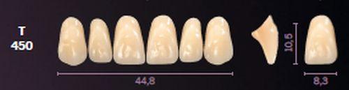 Mondial fortand 6 stk farve A1 T 450*