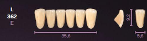 Mondial fortand 6 stk farve A1 L 362