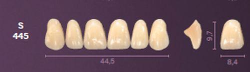 Mondial fortand 6 stk farve A3 S 445