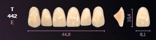Mondial fortand 6 stk farve A3 T 442