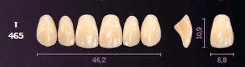 Mondial fortand 6 stk farve A3 T 465