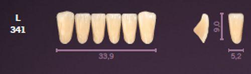 Mondial fortand 6 stk farve A3 L 341