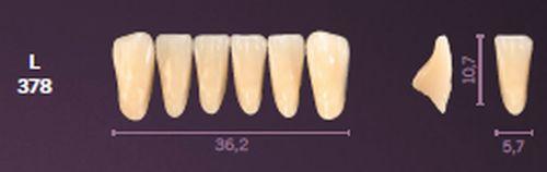 Mondial fortand 6 stk farve A3 L 378