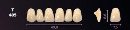 Mondial fortand 6 stk farve C3 T 405
