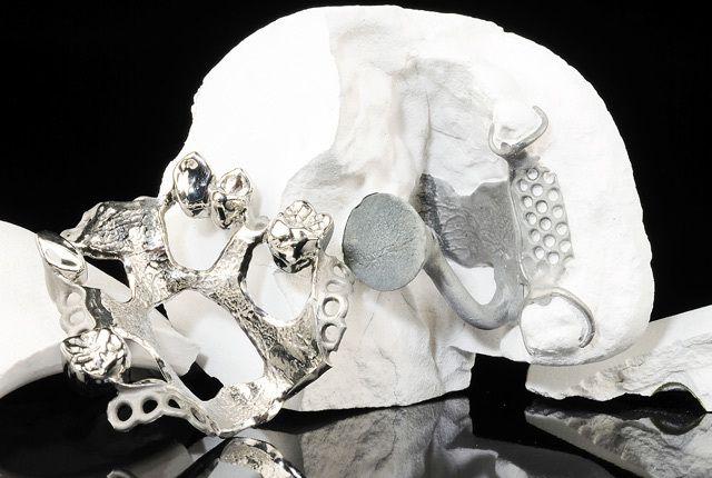 SHERArefract Perfect statsæt*