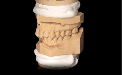 Sheramount Gips 20 kg Hvid