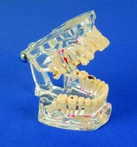 Studie Modell Transparent De Luxe*