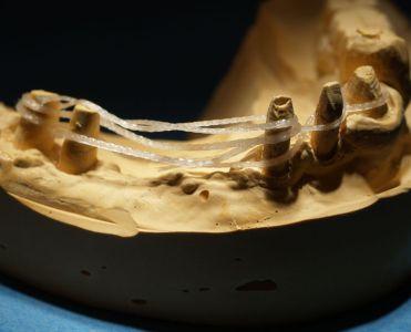 FiberForce Flettet tråd Pink 2.2x150 mm 2 stk*