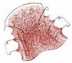 Orthocryl pulver 50 gram disco glitter rød*