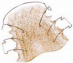 Orthocryl pulver 50 gram disco glitter guld*