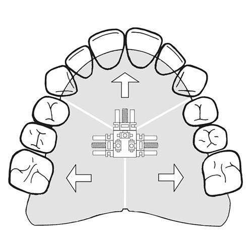 Tornillo Bertoni 5 stk 165-1412