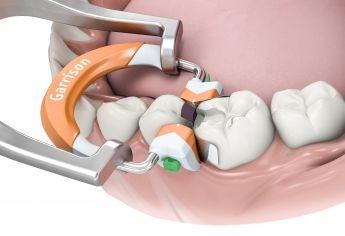 3DFusion matricering standard orange 2 stk