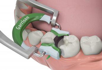 3DFusion matricering bred grøn 2 stk