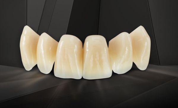 PhysioStar NFC+ fortand 6 stk farve D4 556+*